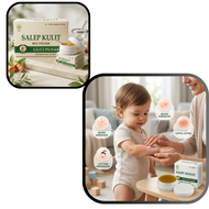 Salep Kulit Gatal Kuman Jamur Buat Bayi Anak Obat Bintik Merah Ruam Popok Biangkeringat Gatel Scabi