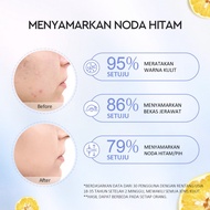 Glad2Glow Yuja Symwhite 377 Dark Spot Moisturizer