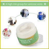 ⚾︎ ◿ ✔ SEFUDUN Vein Cream Varicose Veins Cream Varicose Vein Treatment Cream Varicose Remover Veins