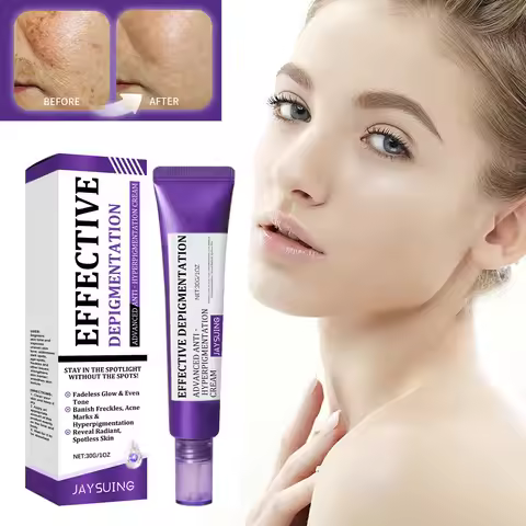 Retinol Brightening Face Cream Fade Melasma Anti Hyperpigmentation Dark Spot Corrector Cream Niacina