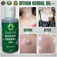 Bitoon Herbal Pure Extract Healing Oil The Organic Medicine for Bukol, Goiter, and Rheumatism