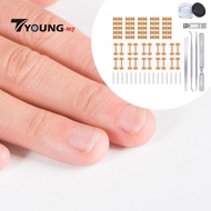 [Available] Ingrown Toenail Correction Kit, Ingrown Toenail Correction Patch, Breathable