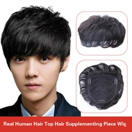 เส้นผมแท้จากคน Top Hairpiece ผู้ชายวิกผมสั้นเกาหลีสไตล์หน้าผากหัวล้านเสริมชิ้นชายวิกผมทรงหน้าม้า Vir