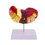 Liver Model Pathological Liver Model For Common Pathologyes, Liver Model Human Anatomy Office Anatom