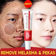 Freckles Removal Cream Melasma Cream Facial Freckle Cream Pekas Remover Cream Whiting Freckle Cream