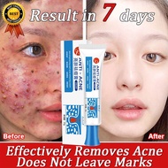Acne Cream Acne Removal Cream Anti Acne Cream Acne Treatment Gel Acne Scar Removal Cream Pimples Cre