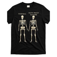 KATUN Ehlers-Danlos Company T-Shirt Syndrome (EDS) - The Unbreakable Series: Terror Symbolist Design