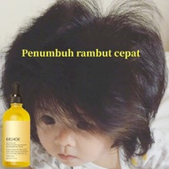 Rosemary oil for hair growth rosemary oil original Hair loss treatment hair tonic growth rosemary oi