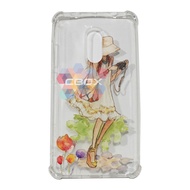 MR Soft Case Anti Crack Xiaomi Redmi Note 4 (14 Picture) Gadis Kamera / Softshell Xiaomi Redmi Note