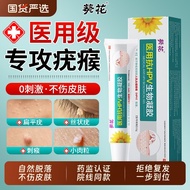 Sunflower Wart Removal Cream Flat Warts Small Meat Pellets Remove Warts A Feel Worry Remove A Feel S