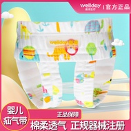 AT-🎇Weide Baby Hernia Belt Convex Navel Special Children Hernia Pocket Pressure Hernia Bag Newborn Baby Groin Belt Breat