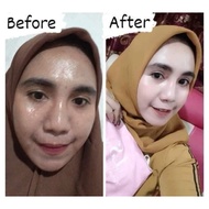 Ls SKINCARE BPOM SKINCARE Package NEW BRIGHTENING BOOSTER BPOM Beauty Care (ELSTM)