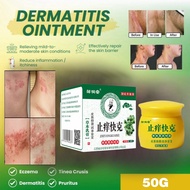 Eczema antifungal cream cream itchy skin cream itchy skin cream itchy skin cream herbal chinese psor