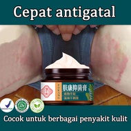 FUKANG Kem nấm ngứa viêm da dị ứng vẩy nến.Chiết xuất từ thảo mộc tự nhiên chính hãng 30g