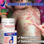 Japan Psoriasis Cream eczema cream Antifungal & Itchy Skin Cream ringworm cream 30g Anti Viral Relie