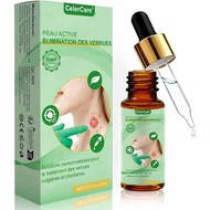 Quickly Effectively Remove Foot Warts, Ordinary Warts, Flat Warts, Foot and Hand Warts Care, Gently 