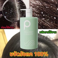 ของแท้ 100% แชมพูขจัดรังแค 500ml ลดผมมัน แก้ผมเสีย ปรับสมดุลสภาพผม ถนอมหนังศรีษะ ให้เส้นผมมีน้ำหนัก แข็งแรง Mild Shampoo แชมพูเร่งผมยาวแชมพูแก้ผมร่วง ผมบาง ปลูกผม เร่งผมเกิดใหม่ ผมยาวไว แช ยาสระผมแก้ร่วง Hair loss shampoo ยับยั้งรังแค แชมพูลดผมร่วง