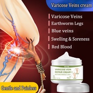 Varicose Veins Cream varicose ointment 50g Varicose Veins Relief Cream Improves varicose veins /spid