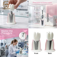 Detachable Large Dental Implant Model | Oral Implant Teaching & Dentist-Patient Communication Demo M