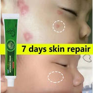 7 Days Psoriasis Repair Cream Eczema Cream Relief Itchy Cream Skin Anti-Itching Antibacterial Cream