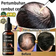 Dr Lan Black Sesame Hair Growth Serum