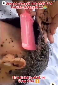 Pembasmi Kutu Rambut TRESNO ASLI MANJUR / Obat Kutu Tresno / Pembasmi Obat kutu tresno manjur / Pude