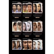 ANTIDOX HIFU-Lift Spray / ANTIDOX