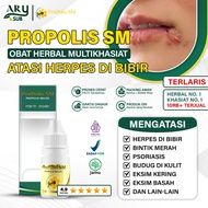 Herpes Medicine on the Lips, Itchy Lips, Genital Herpes, 100% Herbal Propolis SM, COD Available in S