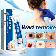 Warts Remover Original Cream Wart Removal Skin Tags Mole Remover Cream Ubat ketuat kutil remover uba