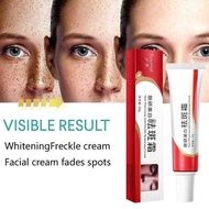 Removal Scar Original Niacamide Dark Spots Remover Whitening And Freckle Brightening Skin Spot Remov