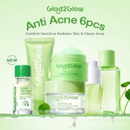 Anti Acne 2 3 4 5 6PCS - Centella Cleanser+Gel Moisturizer 55g+Acne Drying Lotion+Acne Serum+Centell