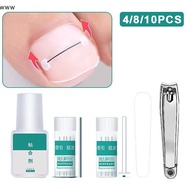 Professional Ingrown Toenail Corrector