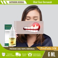 Obat Gusi Bernanah, Obat Sakit Gigi Berlubang, Gigi Linu, Gigi Bengkak, Polip Gigi, Gusi Bengkak Ber