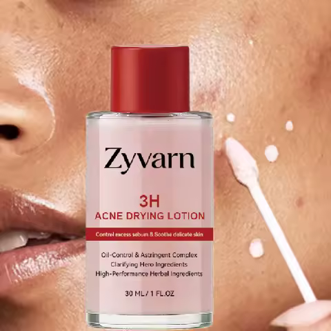 30ml Pink Salicylic Acid Concentrated Acne Essence - Containing Salicylic Acid, Lactose Acid, Calami