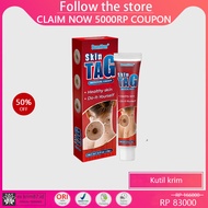 【100-Asli】Obat penghilang kutil Obat kutil kelamin Obat tahi lalat Salep kutil Salep tahi lalat Obat