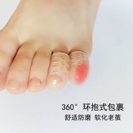 Breathable Silicone Toe Protectors - Prevent Calluses & Corns While Wearing Shoes (S/M)