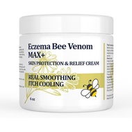 High Strength Bee Venom Cream, Dyshidrotic Eczema Ointment, Heat Rash, Itching, Eczema, Psoriasis, L