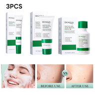 3 Pieces Salicylic Acid Acne Care Set 1 Set Contains 100g Salicylic Acid Acne Mild Cleansing Cream &
