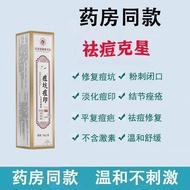 Remove Acne Marks Remove Acne Marks Acne Marks Medical Acne Marks Remove Acne Marks Reduce Acne Mark