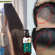 ◎✥Ginger pangpahaba ng buhok shampoo/black beauty shampoo /Shampoo ng kabayo hair growth treatment