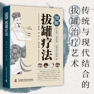 Illustrated Cupping Therapy Super Simple Cupping Whole Book Detox Therapy Illustrated Simple Cupping