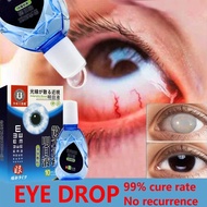 Japan Eye Drops Eye Drops For Dry Eyes for Presbyopia/Dry Eyes/Eye Strain Relief Antibacterial Clean
