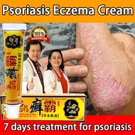 Eczema Treatment Cream Psoriasis Cream Ointment Antibacterial Anti Itch Cream Skin Allergy Ointment