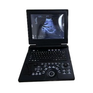 Hospital Portable Color Doppler Echographie 3D 4D Laptop Human Pregnancy Ultrasound Machine
