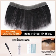 KEQIAO | แผ่นปะผมหน้าผากไม่เห็นได้สำหรับผู้ชาย