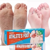 ATHLETES FOOT CREAM Krim kaki atlet anti bau kaki peluh gatal kaki Menghalang Kulat dari Tumbuh/Mere