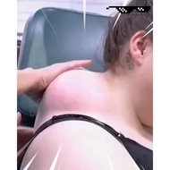 Lipoma Removal Axillary Swelling Lymph Node Dispersing lymphatic drainage Lipoma Lymph Hot Underarm 