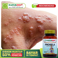 Obat Herpes Zoster Paling Ampuh Penyakit Herves di Bibir Wajah Mata Selangkangan Herpes Kelamin Anak