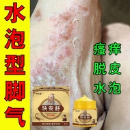 Athlete's Foot Anti-itching Peeling Sterilization Bad Athlete's Athlete's Athlete's Athlete's Athlet