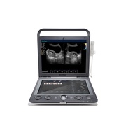 cheapest Portable trolley therapy color doppler Sonoscape 4d ultrasound machine price physiotherapy 